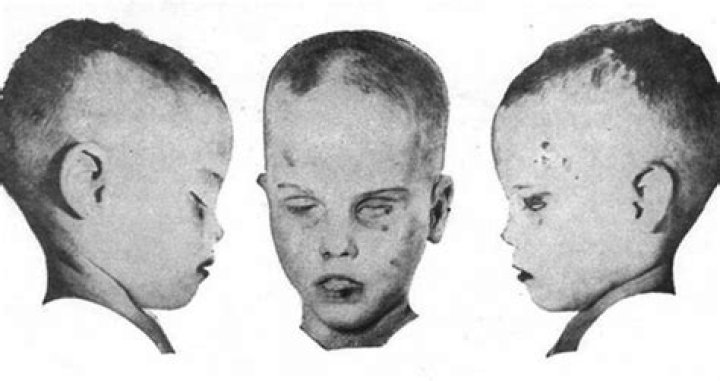 The Mysterious Case That Took Over 60 Years To Solve